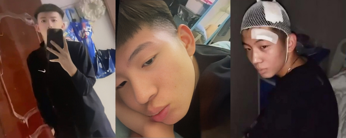 山东济宁泗水村书记之子周恒偷情程妍妍 被揍的满身是伤 仍不忘伤痛继续在病床上打炮