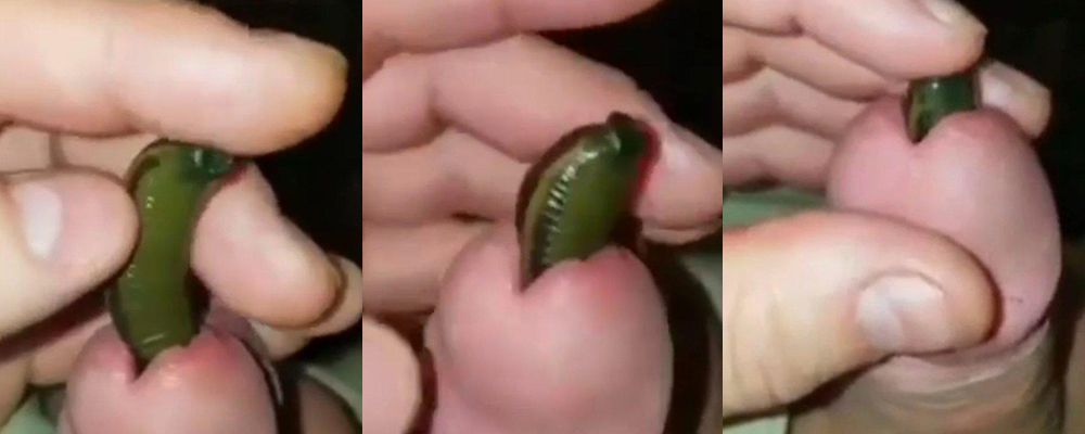 民间出大神 变态小伙挑战血蛭塞马眼 一边撸动鸡巴一边享受另类刺激 看完令人浑身不适