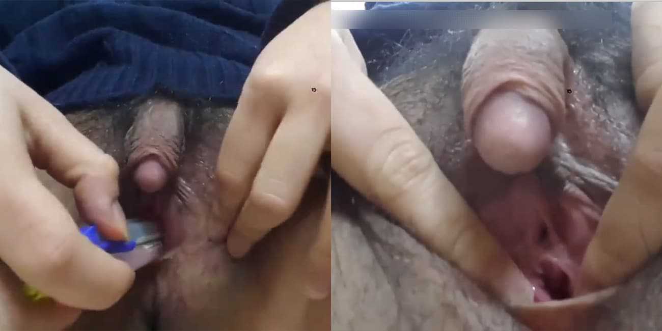 卧槽!我真的是小刀捅屁股开了眼 同时拥有鸡巴和逼逼?