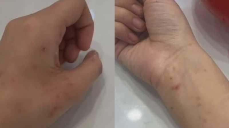 宁波惊现生化母体 故意到处淫乱传播艾滋病毒